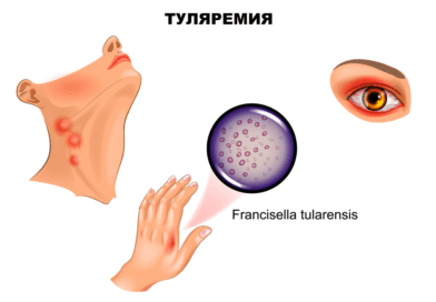 Профилактика по туляремии